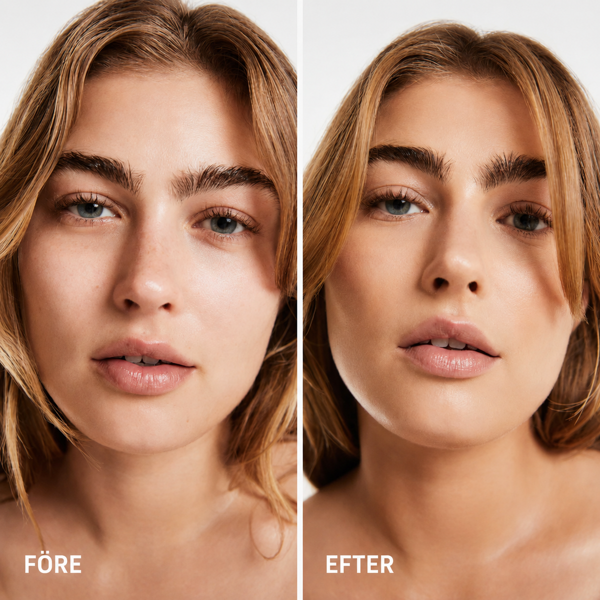 LY-FT – Adapt Foundation